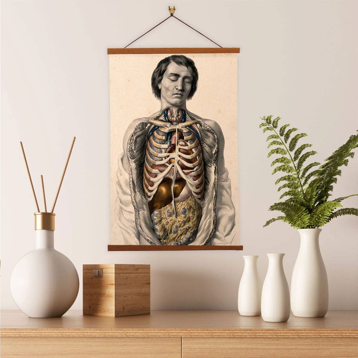 The Body Of a Man With His Trunk Dissected by  William Fairland - Giclee Print on Canvas with Magnetic Hanger