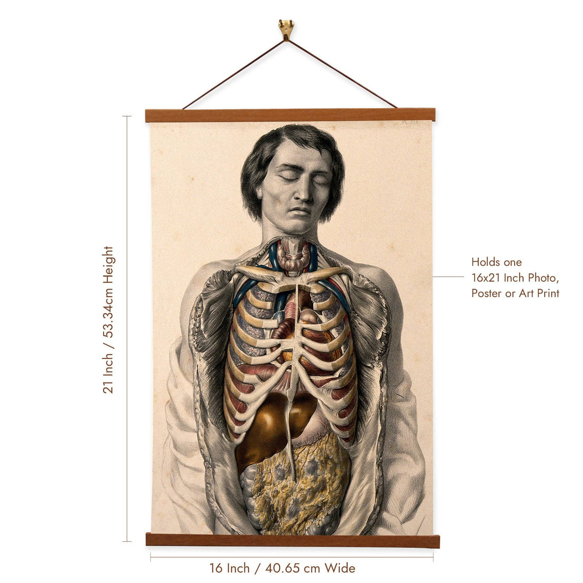 The Body Of a Man With His Trunk Dissected by  William Fairland - Giclee Print on Canvas with Magnetic Hanger