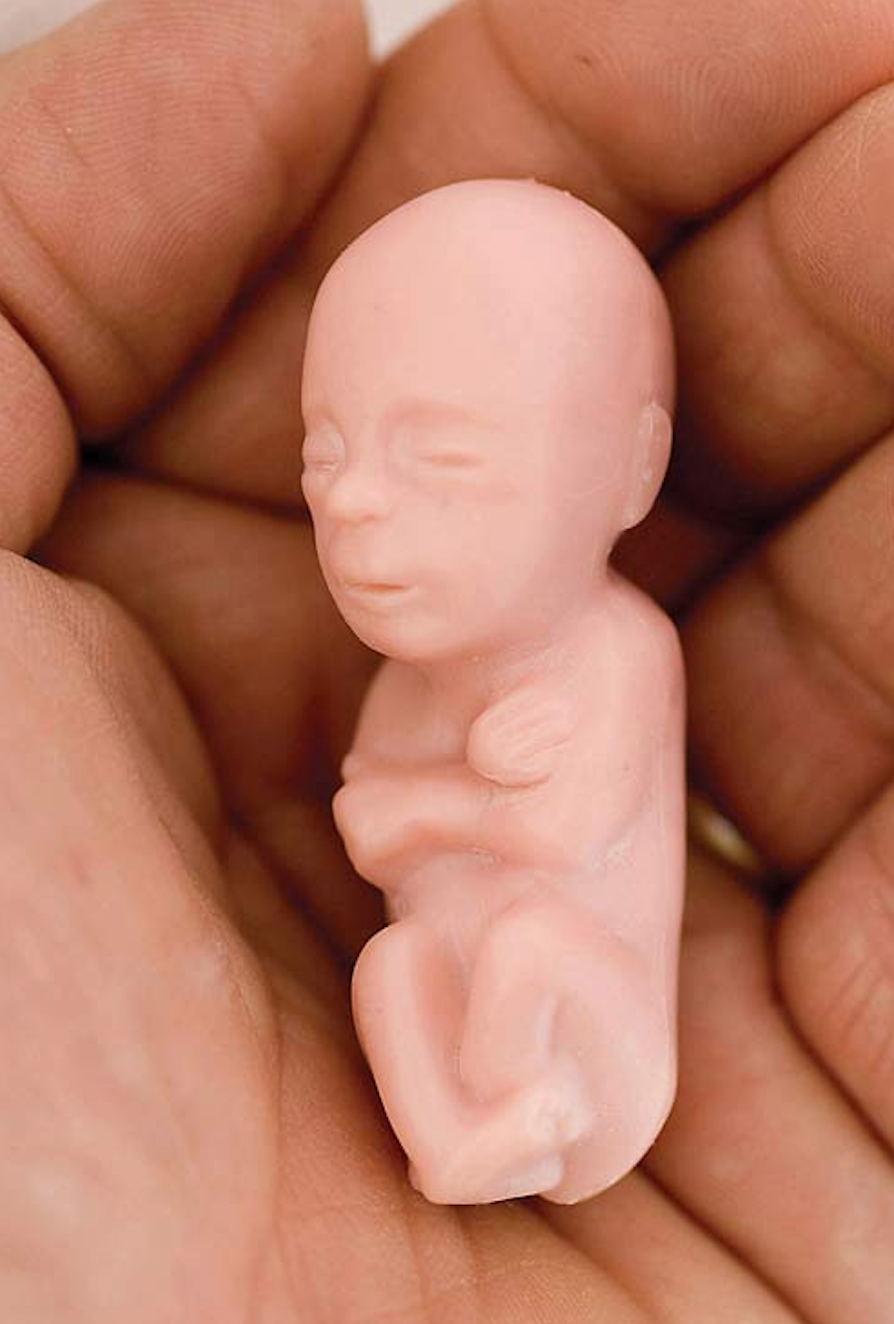 12 Week Fetal Model
