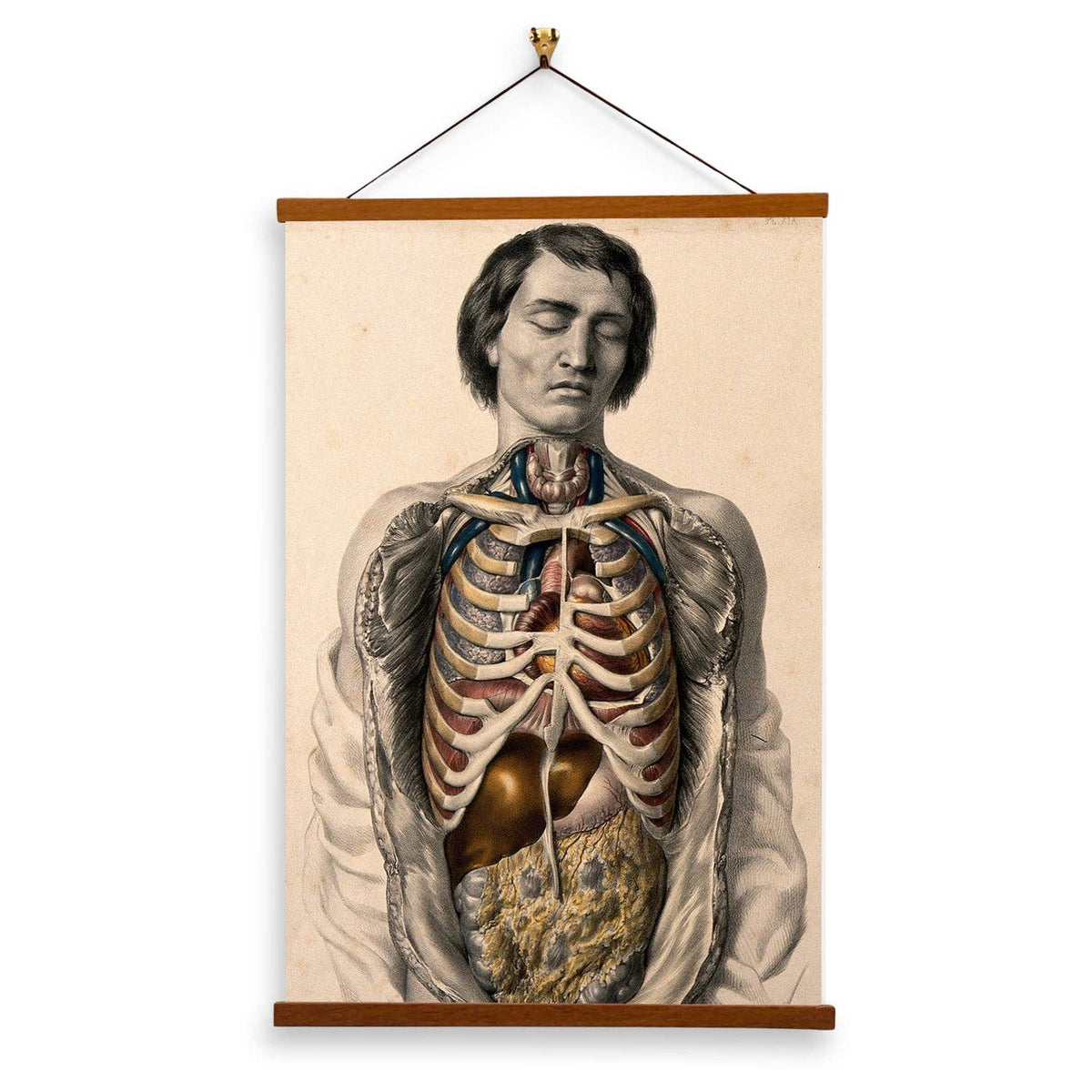 The Body Of a Man With His Trunk Dissected by  William Fairland - Giclee Print on Canvas with Magnetic Hanger