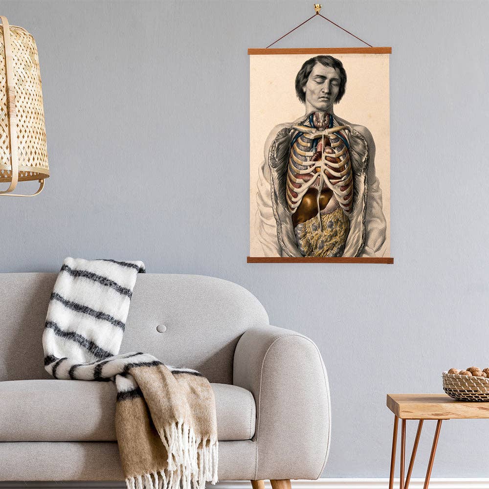 The Body Of a Man With His Trunk Dissected by  William Fairland - Giclee Print on Canvas with Magnetic Hanger